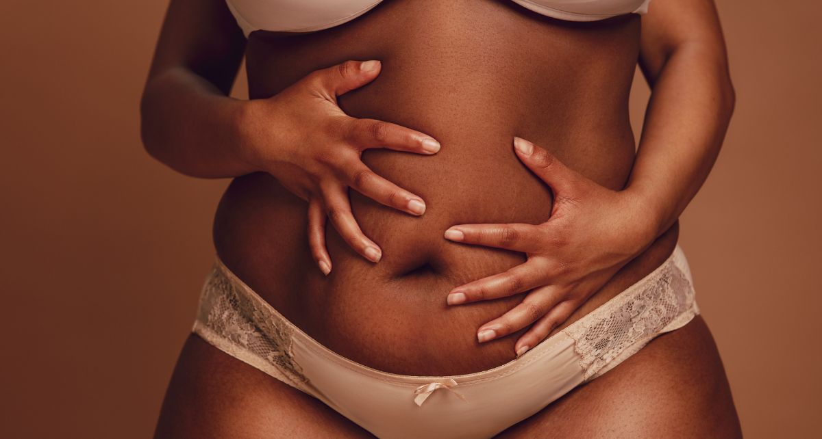 Woman with PCOS in underwear