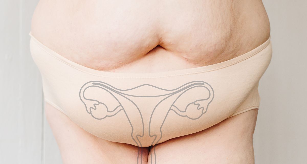 Closeup of a full-figured torso