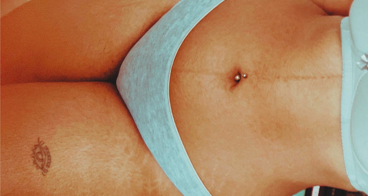 Close-up of woman's abdomen