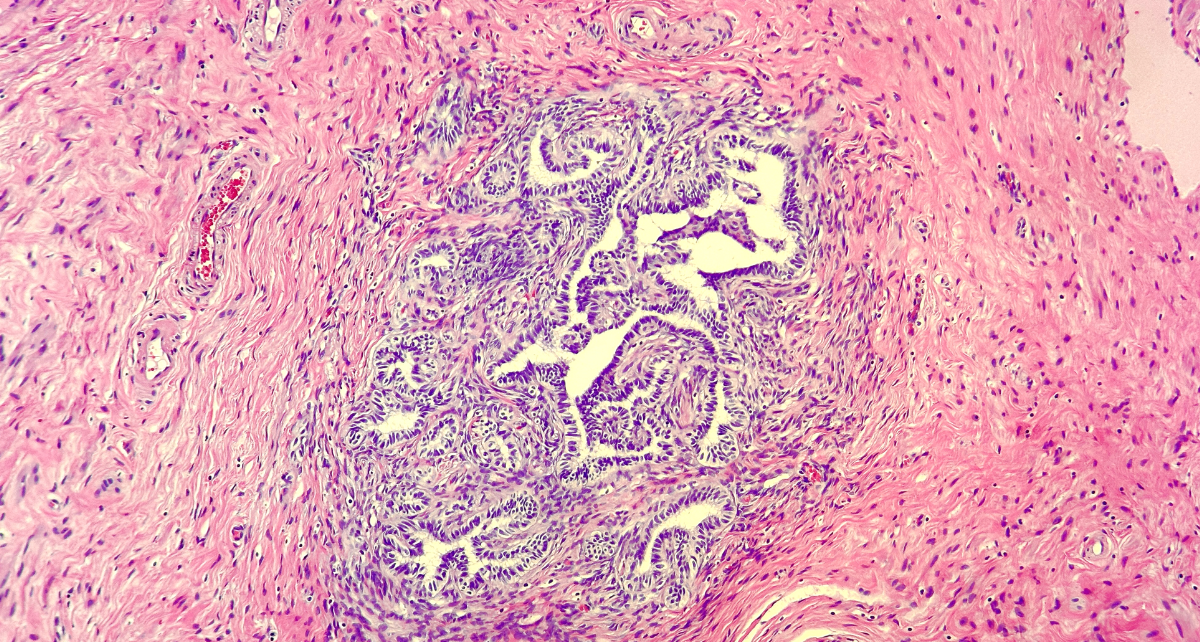 Histology of rete ovarii, in the hilum of an ovary. Image courtesy Wikipedia Mikael Häggström, M.D. 